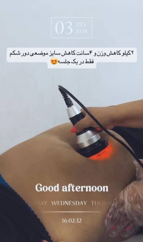 کلینیک پزشکی و زیبایی پوست مو سایه در نواب رشت